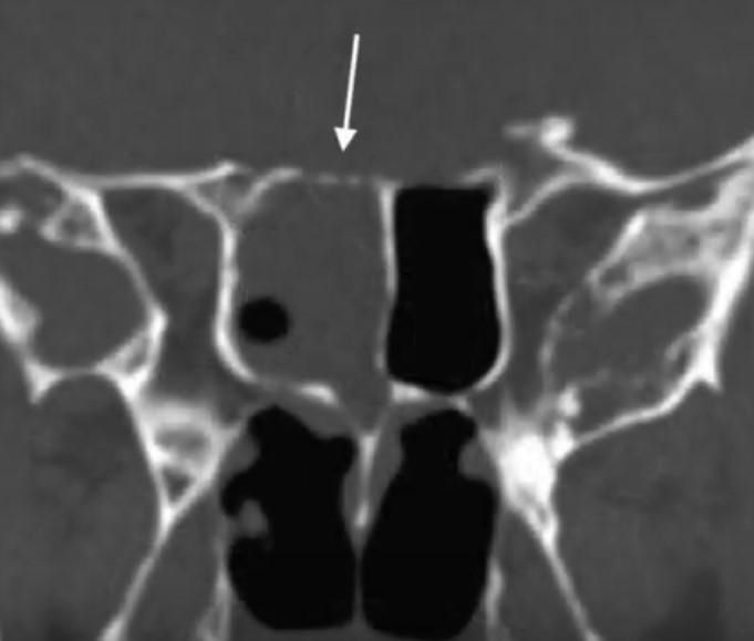 Лікворея 4 фото Лікворея 3 Тернопіль