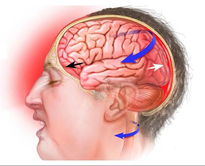 Легкі черепно-мозкові травми 6 фото Легкі черепно-мозкові травми 5 Тернопіль