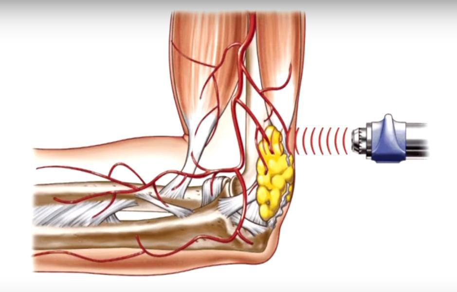 Реабілітаційне лікування 2 фото Реабілітаційне лікування 1 Тернопіль