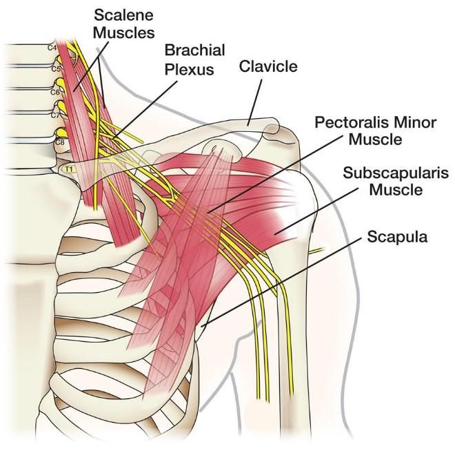 Brachial plexus plexitis 2 фото Brachial plexus plexitis 1 Тернопіль