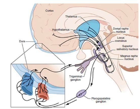 Головний біль 4 фото Головний біль 3 Тернопіль