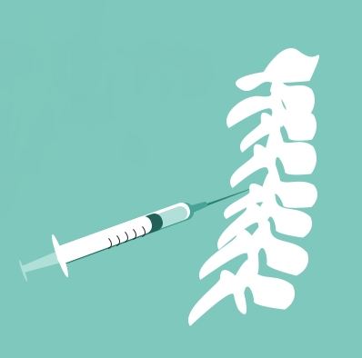 Deformation of the spine 8 фото Deformation of the spine 7 Тернопіль
