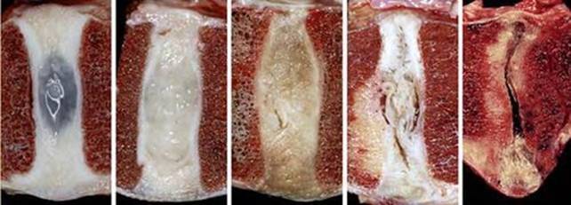 Грижі міжхребцевих дисків на будь-якому рівні 8 фото Грижі міжхребцевих дисків на будь-якому рівні 7 Тернопіль