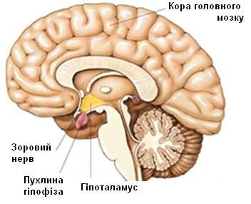 Онкологічні захворювання нервової системи 6 фото Онкологічні захворювання нервової системи 5 Тернопіль