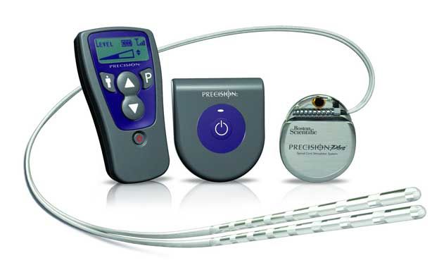 Встановлення електростімулюючих пристроїв 6 фото Встановлення електростімулюючих пристроїв 5 Тернопіль