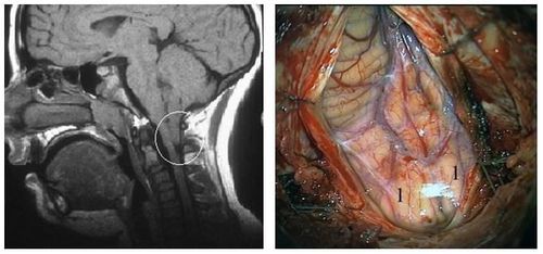 Больові синдроми в нейрохірургії 6 фото Аномалии развития нервной системы 4 херсон