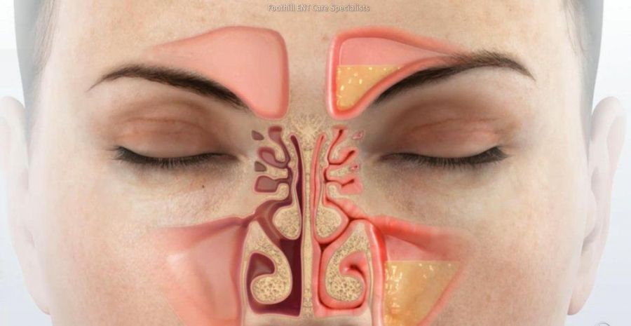 Лікворея 13 фото Лікворея 12 Тернопіль