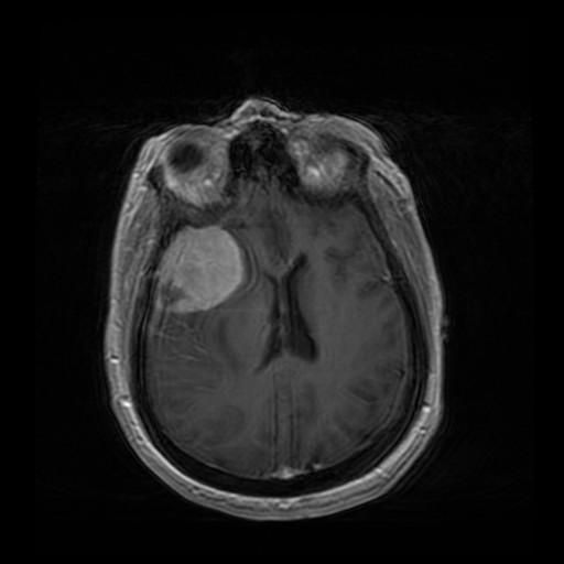 Мононейропатія 3 фото Мононейропатія 2 Тернопіль