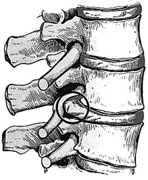 Аневризми головного мозку 5 фото Аневризми головного мозку 4 Тернопіль