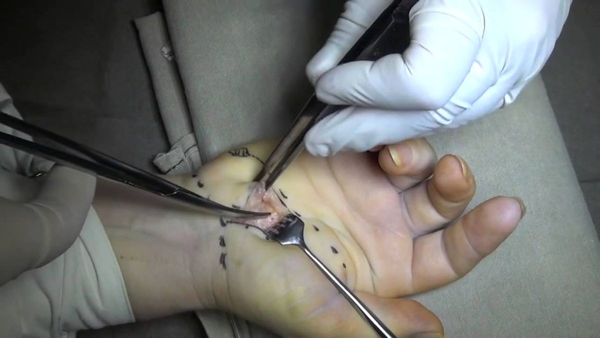 Decompressive-stabilizing intervention 2 фото Decompressive-stabilizing intervention 1 Тернопіль