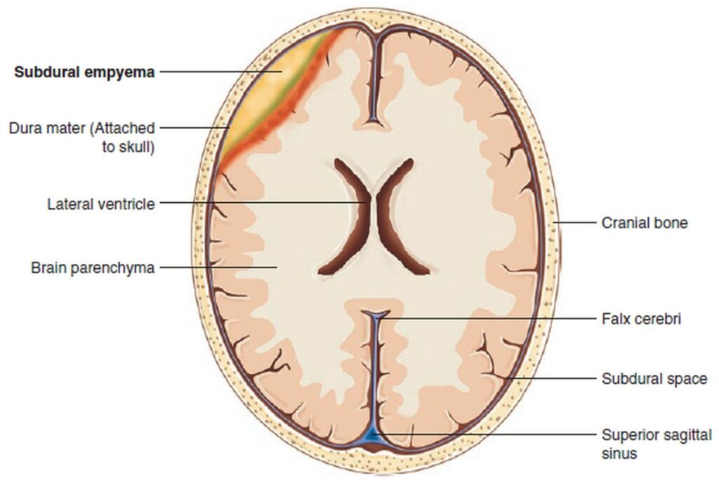 Concussion and mild concussion 5 фото Concussion and mild concussion 4 Тернопіль