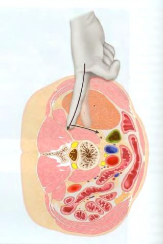 Decompressive and reconstructive spinal surgeries 3 фото Decompressive and reconstructive spinal surgeries 2 Тернопіль