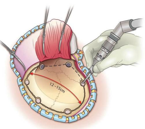 Судинні мальформації ЦНС Судинні мальформації ЦНС