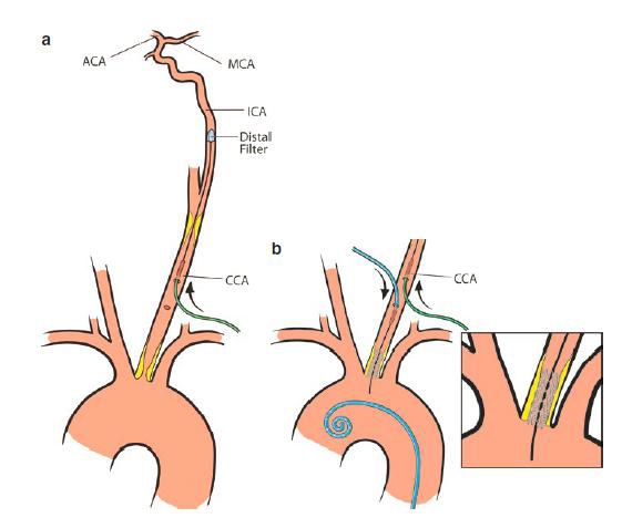 Дегенеративно-дистрофічні захворювання хребта (ДДЗХ) Дегенеративно-дистрофічні захворювання хребта (ДДЗХ)