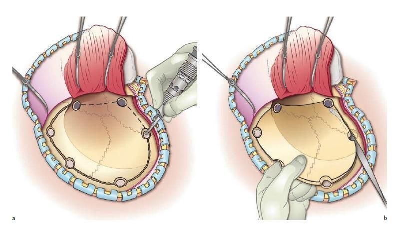 Ізольована черепно-мозкова травма 3 фото Ізольована черепно-мозкова травма 2 Тернопіль