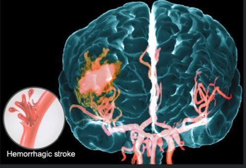 Діагностика судин мозку 7 фото Діагностика судин мозку 6 Тернопіль