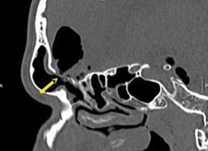 Мононейропатія 5 фото Мононейропатія 4 Тернопіль