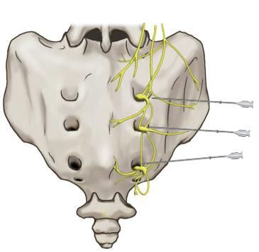 Pain syndromes 3 фото Pain syndromes 2 Тернопіль