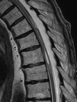 Хірургія арахноїдальної павутини 4 фото Хірургія арахноїдальної павутини 3 Тернопіль