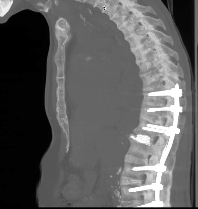 Лікування хвороби Бєхтерева стає досконалішим 5 Тернопіль