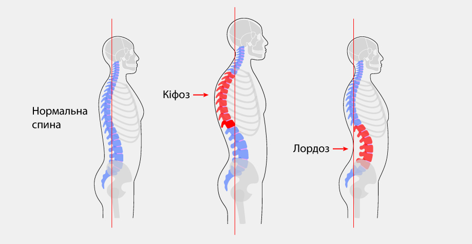 Decompressive-stabilizing intervention 7 фото Decompressive-stabilizing intervention 6 Тернопіль